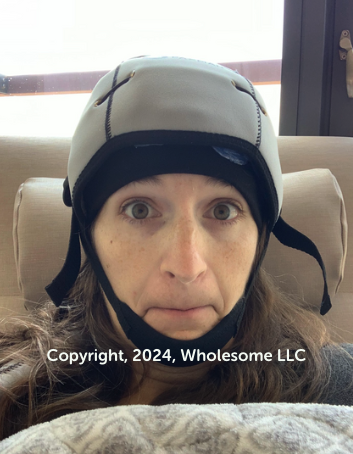 Alison Tierney, a board certified oncology dietitian and cancer survivor wears her cold cap during chemotherapy. Copyright, 2024, Wholesome LLC.